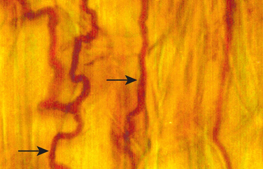 Leaf sheath epidermal peel of Poa secunda subsp. juncifolia infected with Epichloe typhina subsp. poae Ps1 stained with Rose Bengal. Fungal hyphae growing in between the plant cells are indicated by arrows.