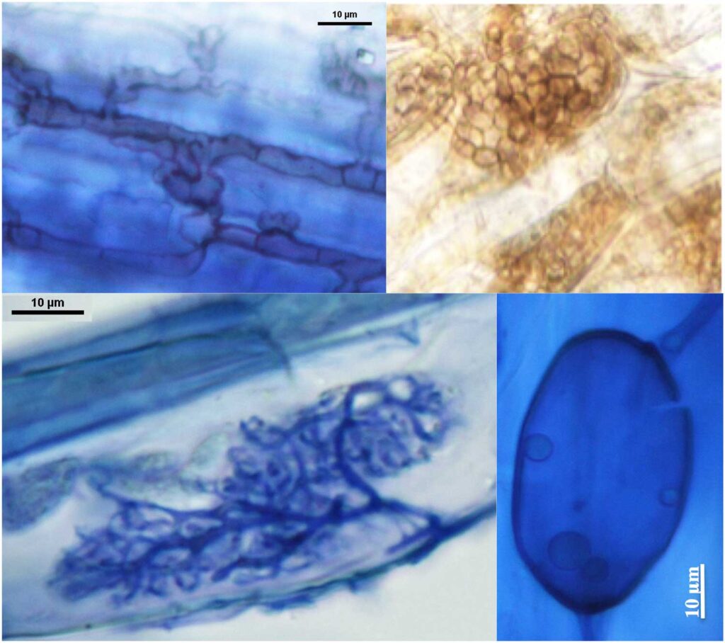 Microscope photo of structures of root associated fungi.